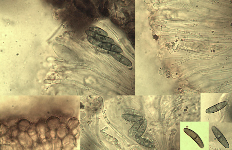 Dactylospora stygia var. striata